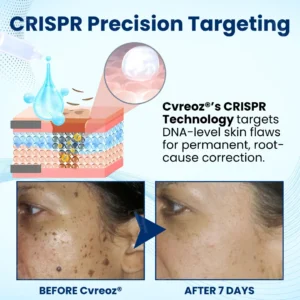 🌟 Official Store | Unlock Flawless Skin with Cvreoz® Skin Radiant Care Drops! 🌟 Say Goodbye to Imperfections!