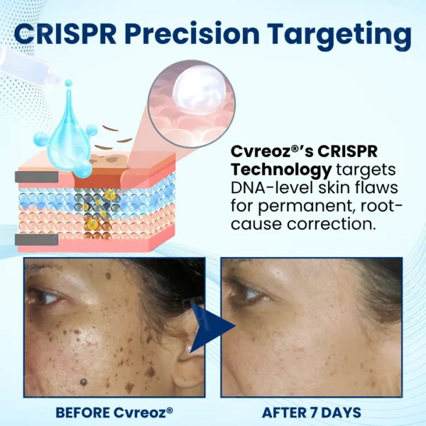 🌟 Official Store | Unlock Flawless Skin with Cvreoz® Skin Radiant Care Drops! 🌟 Say Goodbye to Imperfections!
