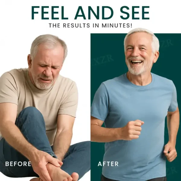 Cvreoz® GoutEase Relief Spray