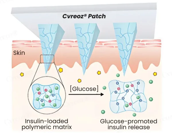 Cvreoz® InsuliNeedle Glucose Control Microneedling Patch