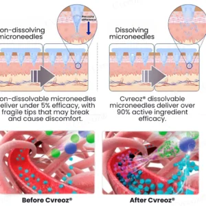 Cvreoz® InsuliNeedle Glucose Control Microneedling Patch