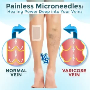Cvreoz® VenaRestore MicroNeedle Vein Repair Patch