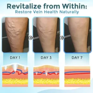 Cvreoz® VenaRestore MicroNeedle Vein Repair Patch